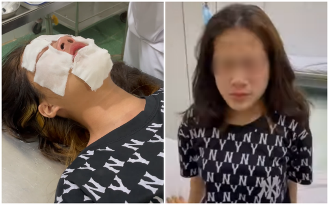 Chọc ghẹo nữ sinh không thành, nam thanh niên cay cú hành hung, xịt hơi cay vào mặt rồi bỏ đi - Ảnh 2.