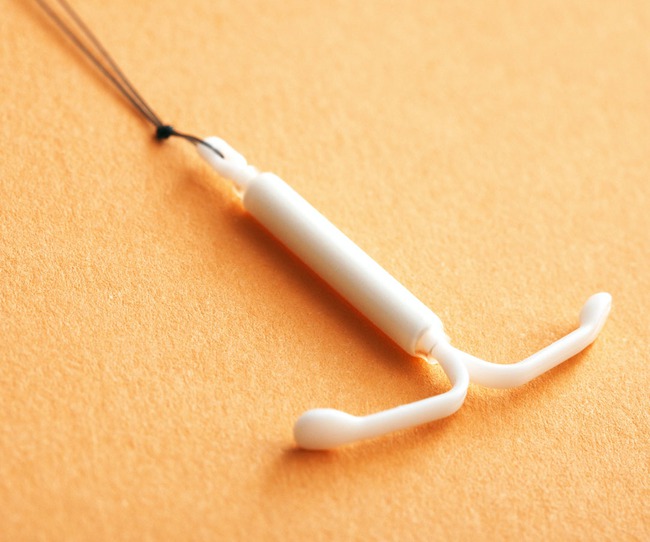 TikToker tự tháo vòng tránh thai tại nhà, chuyên gia nói gì về việc làm này - Ảnh 2.