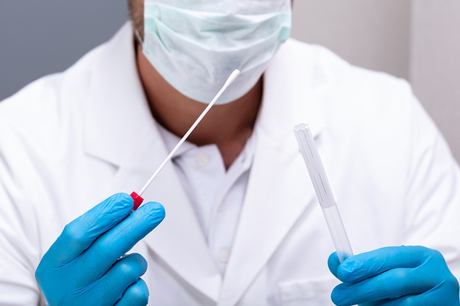 Nghiên cứu mới: Xét nghiệm chẩn đoán Covid-19 qua nước bọt có độ nhạy cao không kém ngoáy mũi! - Ảnh 4. Nghiên cứu mới: Xét nghiệm chẩn đoán Covid-19 qua nước bọt có độ nhạy cao không kém ngoáy mũi! - Ảnh 4.