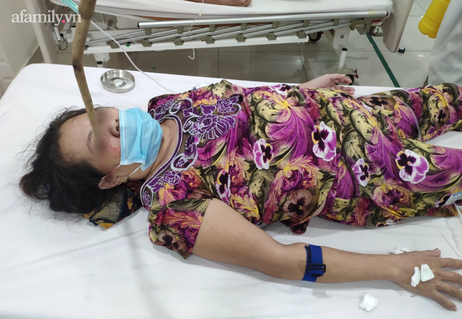 Tai nạn kinh hoàng: Người phụ nữ ở TP.HCM bị thanh tre cắm thẳng vào mắt, xuyên đến não - Ảnh 1.