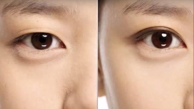 Cắt mắt 2 mí đẹp tự nhiên: Chuyên gia tiết lộ từ quy trình đến lưu ý để mắt đẹp sâu hút hồn - Ảnh 11.