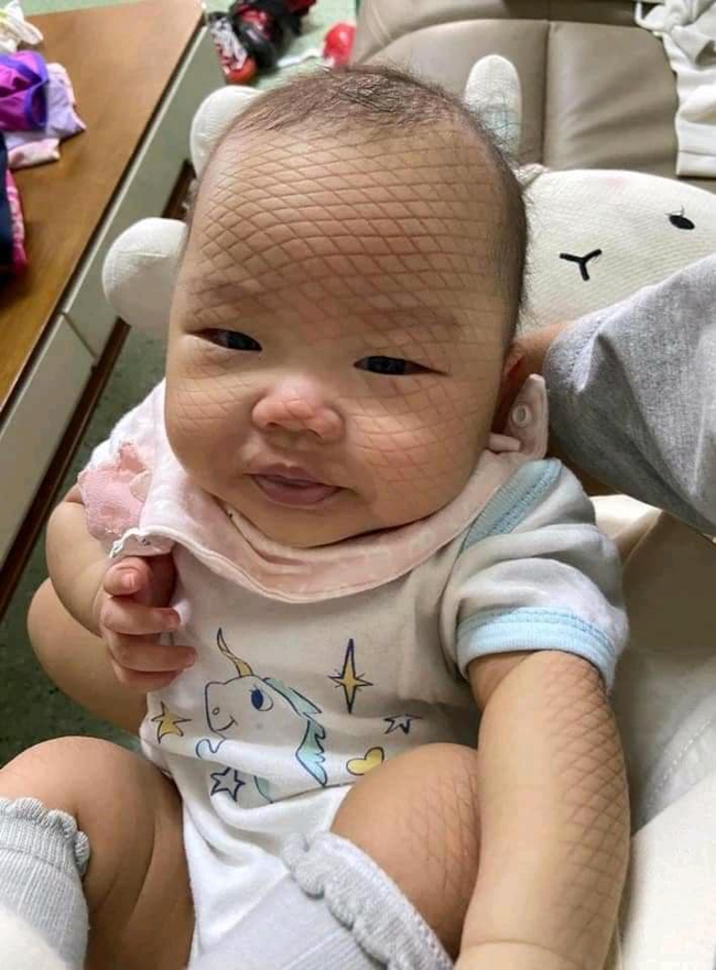 Để con ngủ quên trên võng, gương mặt của bé lúc tỉnh dậy khiến mẹ bỉm hết hồn, vội vàng xin lỗi con - Ảnh 2. Để con ngủ quên trên võng, gương mặt của bé lúc tỉnh dậy khiến mẹ bỉm hết hồn, vội vàng xin lỗi con - Ảnh 2.