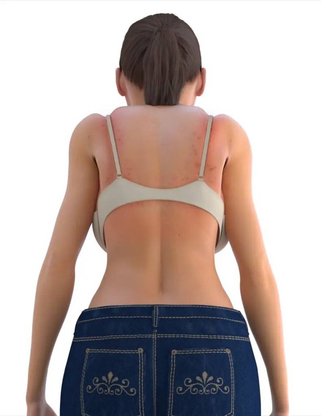 Nhìn &quot;người mẫu&quot; 3D này, chị em sẽ biết ngay tác hại của việc mặc 1 chiếc áo ngực không phù hợp - Ảnh 3.