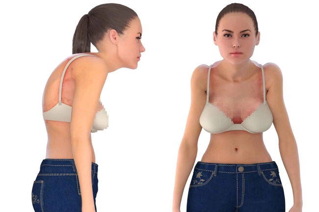 Nhìn &quot;người mẫu&quot; 3D này, chị em sẽ biết ngay tác hại của việc mặc 1 chiếc áo ngực không phù hợp - Ảnh 1.