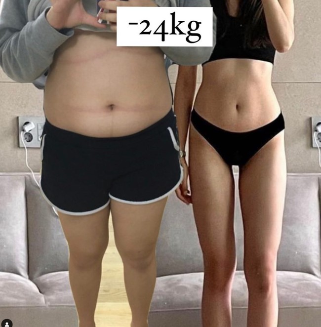 Hiểu rõ 4 thời điểm tích mỡ để không bị tích mỡ thừa gây tăng cân - Ảnh 1.