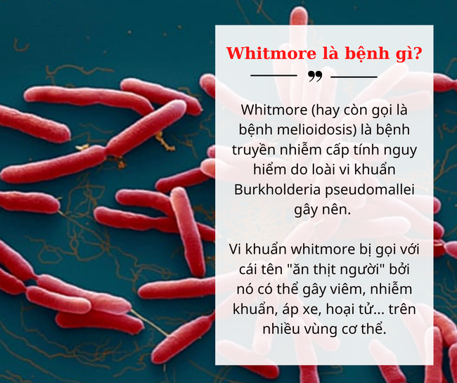 Đã có bệnh nhi tử vong vì nhiễm vi khuẩn gây bệnh Whitmore: Bệnh nguy hiểm như thế nào? - Ảnh 1.