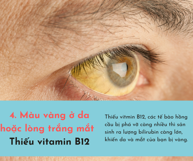 Cơ thể bị "cạn kiệt" vitamin sẽ phát ra 6 dấu hiệu, chủ quan bỏ qua có thể sẽ tổn thọ  - Ảnh 4.