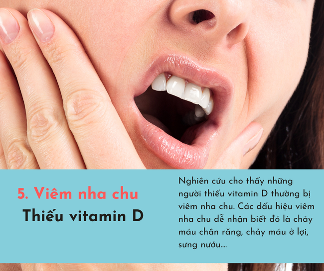 Cơ thể bị "cạn kiệt" vitamin sẽ phát ra 6 dấu hiệu, chủ quan bỏ qua có thể sẽ tổn thọ  - Ảnh 5.