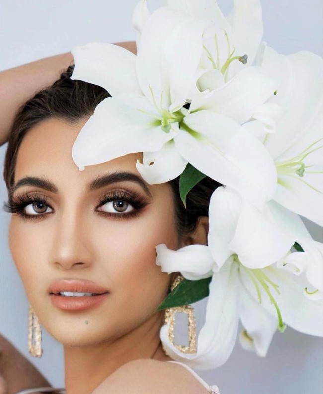 Miss World 2021 runner-up: Indian-American beauties once suffered severe burns to face deformity, suddenly reappeared with a surprising appearance - Photo 3.