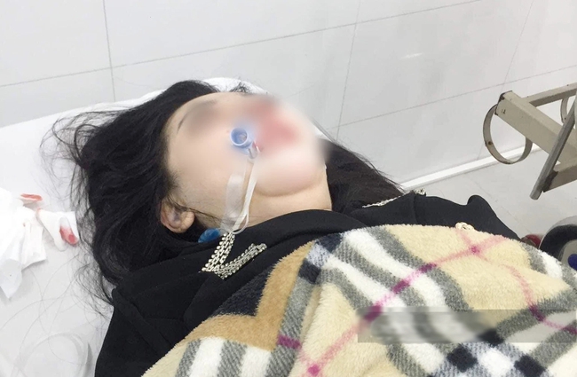 22-year-old single mother died because of rhinoplasty in Hanoi: The police got involved, how is the person who lends a place to do cosmetology related?  - Photo 1.
