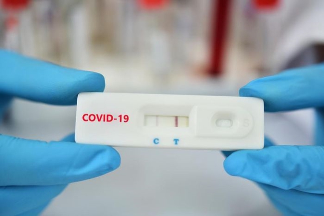 Test nhanh Covid-19 hiện một vạch đậm một vạch mờ chứng tỏ tải lượng virus thấp? - Ảnh 1.