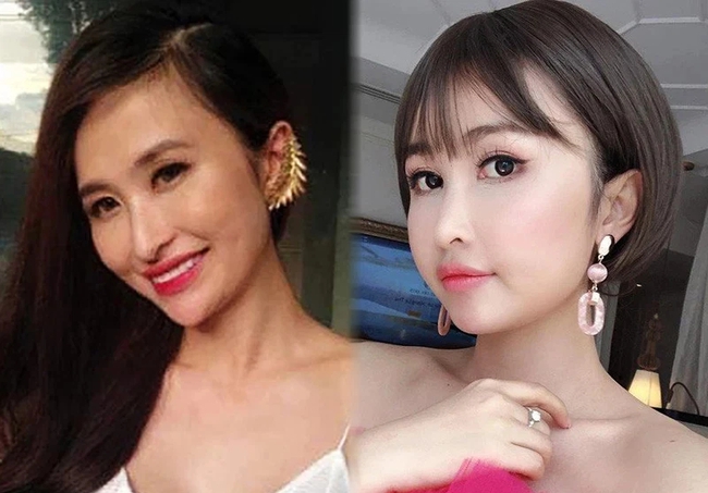 baby cheek injection - Photo 3. baby cheek injection - Photo 3.