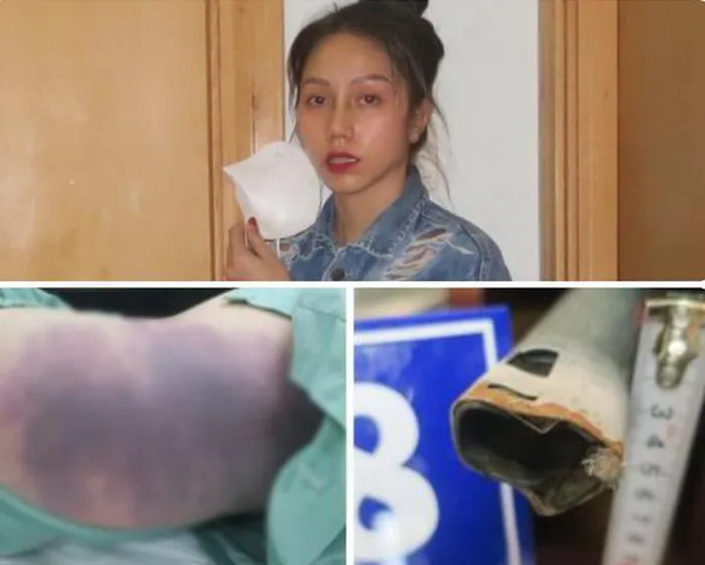 8-year-old girl in Ho Chi Minh City was 8-year-old girl in Ho Chi Minh City was