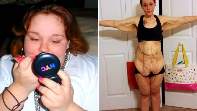 Determined to lose 152kg so that her children can be proud of her, the woman regrets deeply with her saggy body and unbelievable transformation screen - Photo 1.