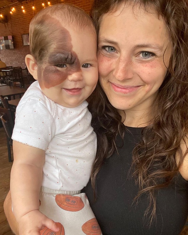 The girl was born with a rare birthmark on her face: The way a mother teaches her child to be confident and smile makes everyone want to learn - Photo 1.