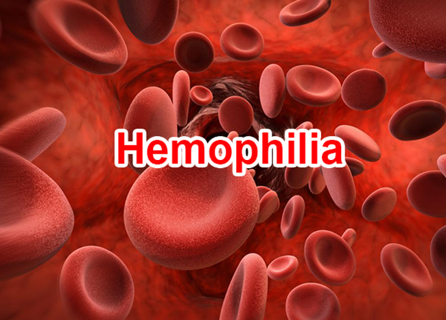 My first child has hemophilia, what should I do to give birth to a healthy baby?  - Photo 3.