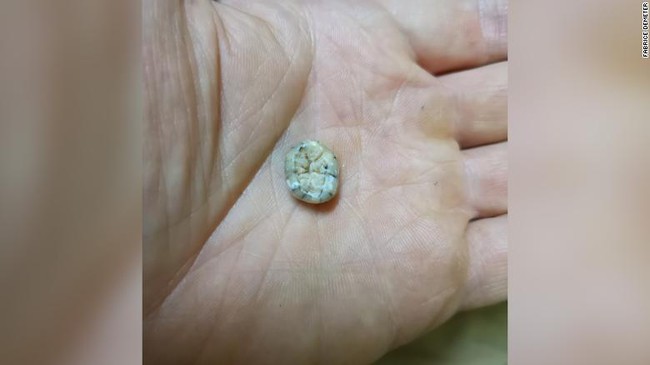 Discovering a 131,000-year-old baby tooth in the Truong Son mountain range, archaeologists were surprised about the ancient human past in Southeast Asia - Photo 1.