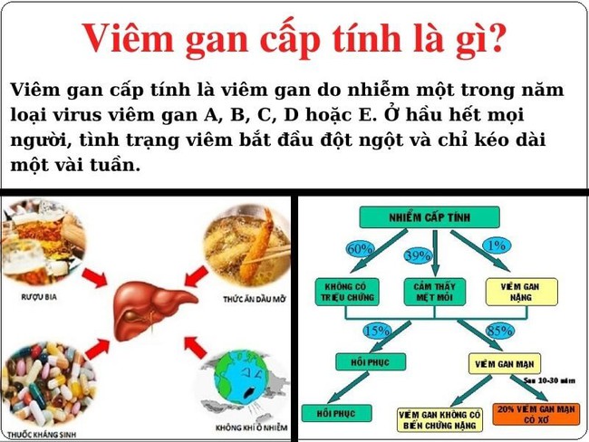 Bộ Y tế yêu cầu tăng cường giám sát bệnh viêm gan cấp tính không rõ nguyên nhân - Ảnh 1.