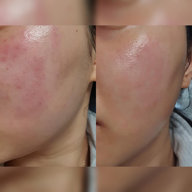 Chăm da sai c&aacute;ch th&igrave; c&ograve;n &ldquo;n&aacute;t&rdquo; hơn cả b&ocirc;i kem trộn, chuy&ecirc;n gia chỉ ra điều quan trọng nhất gi&uacute;p phục hồi da thương tổn - Ảnh 3.