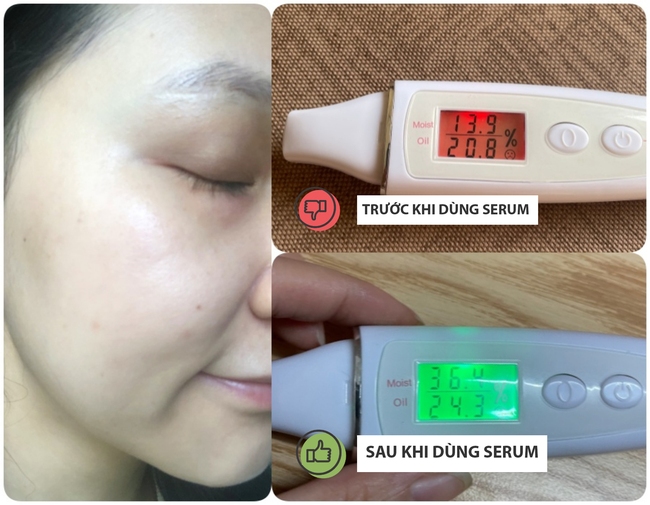 Lọ serum cấp ẩm &quot;oversized&quot; giá chỉ hơn 100k: Từ mặt đến người đều ẩm mượt láng mịn - Ảnh 5.