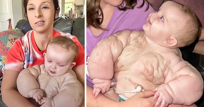 Gặp gỡ “Baby Hulk”: Em bé đáng yêu và hành trình giành giựt sự sống 1 - Ảnh 4.