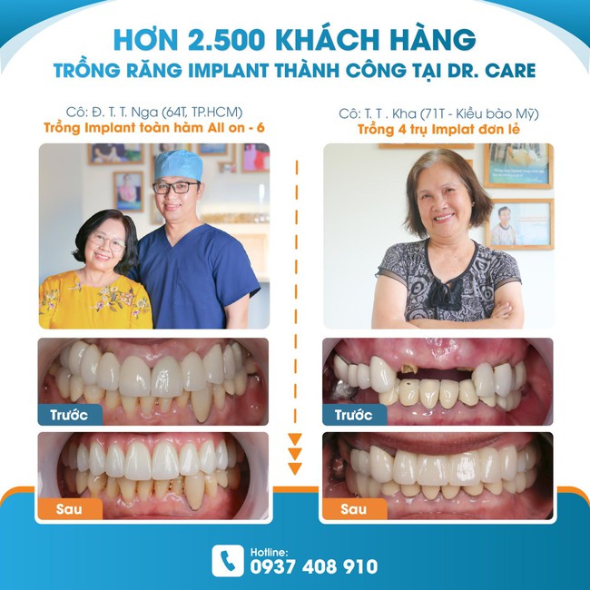 Dr. Care Implant Clinic - Nha khoa chuyên sâu trồng răng Implant tại TP.HCM - Ảnh 5.