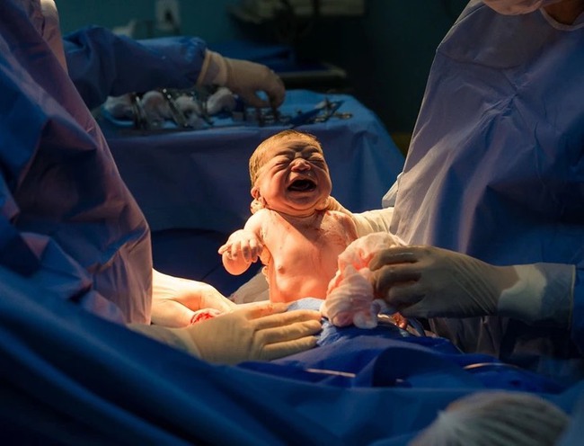 Em bé sơ sinh gây bão với khuôn mặt gắt gỏng lúc mới chào đời - Ảnh 2.