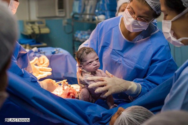 Em bé sơ sinh gây bão với khuôn mặt gắt gỏng lúc mới chào đời - Ảnh 3.