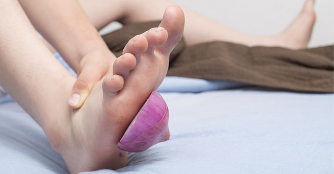 Mùa đông đặt hành tây vào lòng bàn chân khi ngủ, chữa dứt điểm 3 bệnh thường gặp - Ảnh 1.