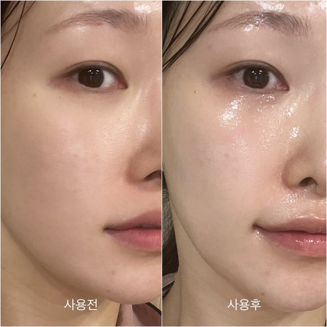 Thời điểm dùng serum phát huy tối đa hiệu quả cho da mụn, da dầu, da lão hóa - Ảnh 4.