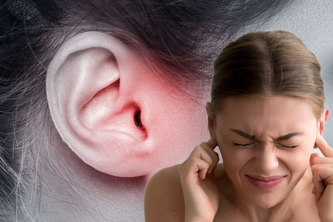 Chớ coi thường ù tai, có thể là dấu hiệu sớm của một số bệnh đang “ủ mầm” trong người - Ảnh 4.