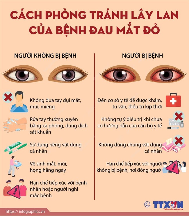 Cách phòng tránh lây lan của bệnh đau mắt đỏ - Ảnh 1.