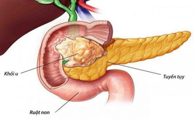 2 món ăn vặt bí mật &quot;hủy diệt&quot; tuyến tụy của bạn, bác sĩ khuyên dù nam hay nữ cũng nên ăn ít đi để phòng bệnh tiểu đường - Ảnh 3.