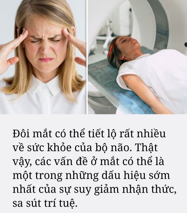 Gặp dấu hiệu này khi nhìn, rất có thể bạn đang bị sa sút trí tuệ, các nhà thần kinh học khuyên bạn cần làm một việc - Ảnh 1.