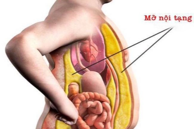 Ăn 1 trong 5 loại quả sau &quot;bơm&quot; đường kinh khủng hơn cả uống nước đường, người muốn giảm mỡ nội tạng phải tránh ngay - Ảnh 5.