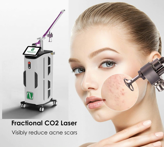 Ứng dụng công nghệ laser giúp chăm sóc da toàn diện cho các chị em - Ảnh 2.