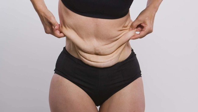 how-to-get-lid-of-loose-skin-after-weight-loss-17085685627422143457140-1708661167113-17086611672141799960015.jpg