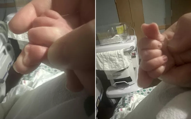 Bà mẹ phát hiện con trai chào đời với ngón tay cái 'hình trái tim' hiếm có - Ảnh 1.