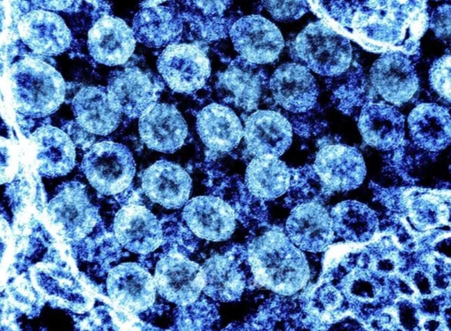 Biến thể phụ KP.2 của virus SARS-CoV-2 có thể lây lan nhanh hơn và 'né' miễn dịch tốt hơn - Ảnh 1.