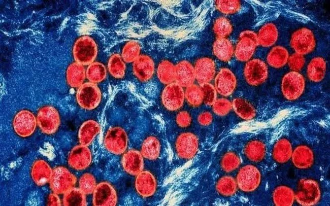 Pháp phát hiện ca nhiễm biến thể mới của virus đậu mùa khỉ - Ảnh 1.