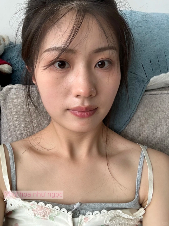 Tôi bất ngờ vì dùng serum collagen kèm cây lăn kim, gương mặt mộc của tôi “lên hương” rõ rệt - Ảnh 1.
