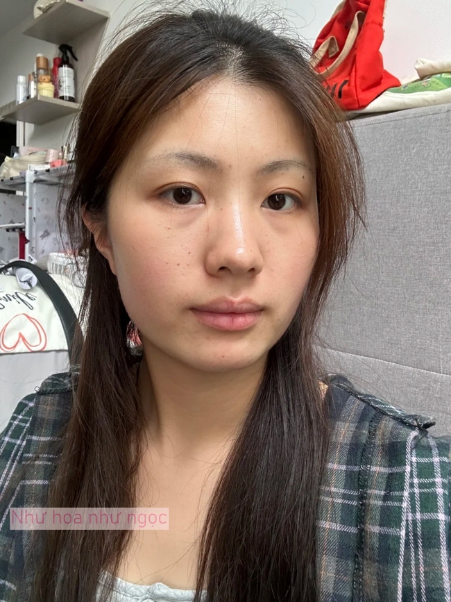 Tôi bất ngờ vì dùng serum collagen kèm cây lăn kim, gương mặt mộc của tôi “lên hương” rõ rệt - Ảnh 2.