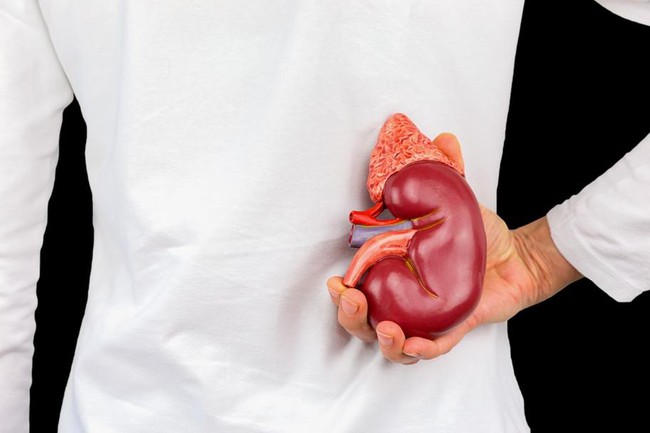 Người đàn ông bị sỏi thận đã uống nước chanh mỗi ngày, anh được bác sĩ "tặng" ngay 5 từ trong lần tái khám - Ảnh 4. Người đàn ông bị sỏi thận đã uống nước chanh mỗi ngày, anh được bác sĩ "tặng" ngay 5 từ trong lần tái khám - Ảnh 4.
