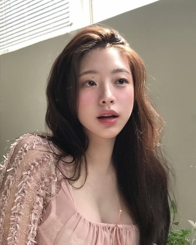 Soi kỹ công nghệ chỉnh nha Meaw – vì sao được săn đón? - Ảnh 4. Soi kỹ công nghệ chỉnh nha Meaw – vì sao được săn đón? - Ảnh 4.