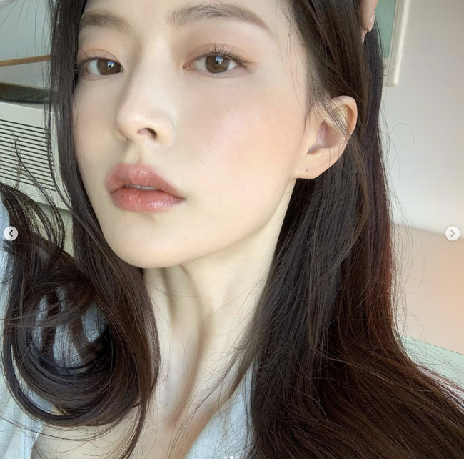 Soi kỹ công nghệ chỉnh nha Meaw – vì sao được săn đón? - Ảnh 5. Soi kỹ công nghệ chỉnh nha Meaw – vì sao được săn đón? - Ảnh 5.