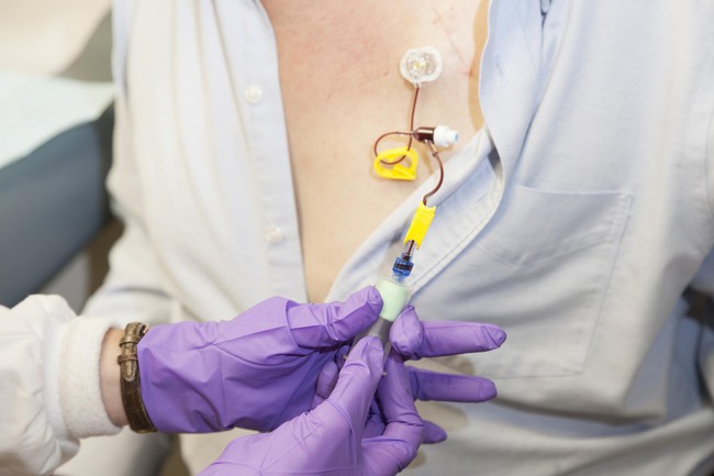 &Iacute;t người nhận ra Vương phi Kate đ&atilde; kh&eacute;o che giấu thiết bị y tế gắn tr&ecirc;n người thế n&agrave;o khi xuất hiện c&ocirc;ng khai - Ảnh 2.