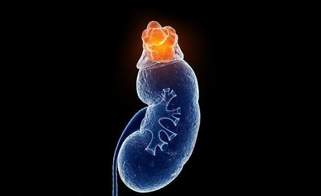 "Con tôi chỉ bị viêm mũi dị ứng thôi mà...": Người mẹ khóc nấc không ngờ thói quen xịt mũi lại khiến con bị suy tuyến thượng thận - Ảnh 4. "Con tôi chỉ bị viêm mũi dị ứng thôi mà...": Người mẹ khóc nấc không ngờ thói quen xịt mũi lại khiến con bị suy tuyến thượng thận - Ảnh 4.