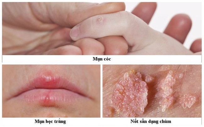 hpv-la-gi-va-nhung-van-de-lien-quan-3-1746169206272495888030.jpg