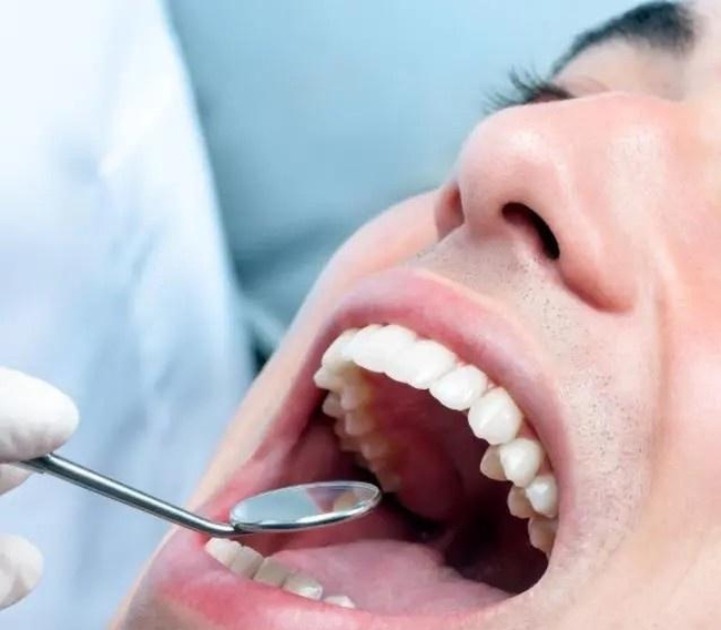 Để có 20 chiếc răng khỏe mạnh ngay cả khi ở tuổi 80, bác sĩ khuyến cáo cần làm được 3 việc từ khi còn trẻ - Ảnh 3. Để có 20 chiếc răng khỏe mạnh ngay cả khi ở tuổi 80, bác sĩ khuyến cáo cần làm được 3 việc từ khi còn trẻ - Ảnh 3.