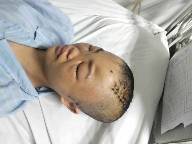 Mẹ suy thận giai đoạn cuối cầu xin sự sống cho con gái nguy kịch vì tai nạn giao thông - Ảnh 1. Mẹ suy thận giai đoạn cuối cầu xin sự sống cho con gái nguy kịch vì tai nạn giao thông - Ảnh 1.